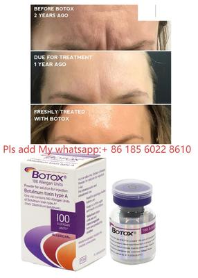 Allergan Botox 100IU Tiêm Dysport Botulax Độc tố Botulinum Xóa Nếp nhăn