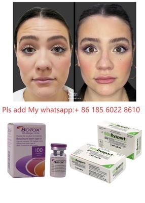 Botulinum Toxin Allergan Botox 100IU để Giảm Nếp Nhăn và Thẩm Mỹ