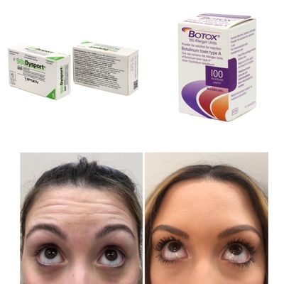 100 đơn vị Hàn Quốc BTX Botulinum Toxin cho nếp nhăn và đường nếp mịn