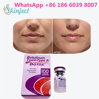 Botulinum Toxin ALLERGAN BOTOX Thời gian từ 4 đến 6 tháng 100 đơn vị loại A