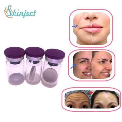 Tiêm Botox Xóa Nếp Nhăn Botulinum Toxin 100 đơn vị Botox Allergan Vùng Mặt Điều Trị