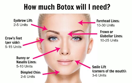 Thẩm mỹ viện gây dị ứng Hàn Quốc Botulinum Toxin chống lão hóa và xóa nếp nhăn