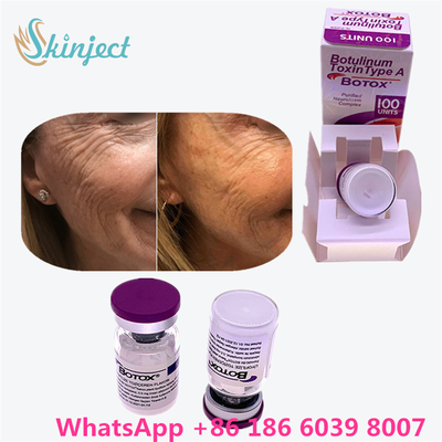 Botulinum Toxin Allergan Botox Bột Trắng Điều trị hiệu quả nếp nhăn trên khuôn mặt và thư giãn cơ trong y tế