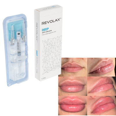 Revolax Hyaluronic Acid Dermal Filler Natural Plump Lip Augmentation Phục hồi khối lượng khuôn mặt