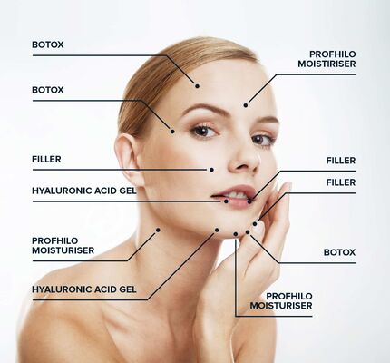 64mg Phương pháp điều trị chống lão hóa nồng độ cao (1x2ml) Profhilo H+L Bio-Remodeling Injectable Dermal Filler
