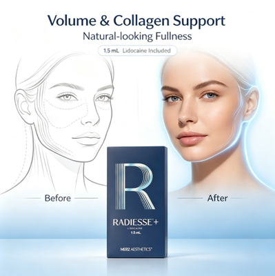 Chất làm đầy tăng sinh collagen Radiesse giúp điều chỉnh tức thì các nếp nhăn sâu trên mặt