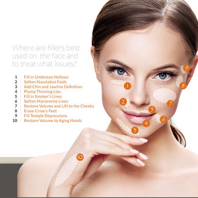 Skinject Hyaluronic Acid Gel Filler Tiêm Trán Xóa nếp nhăn