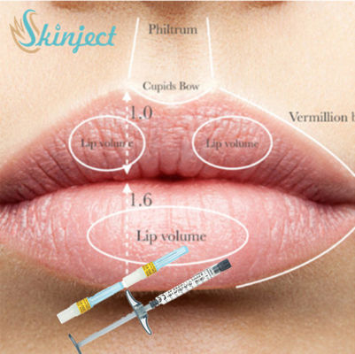 Full Lip Cheek Tiêm Chất làm đầy Da Môi Hyaluronic Acid HA Filler 1ml 2ml 5ml