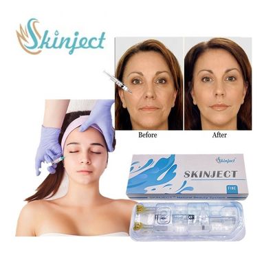 Skinject 1ml Chất làm đầy axit hyaluronic mịn chống lão hóa Chống nếp nhăn Tiêm chất làm đầy da