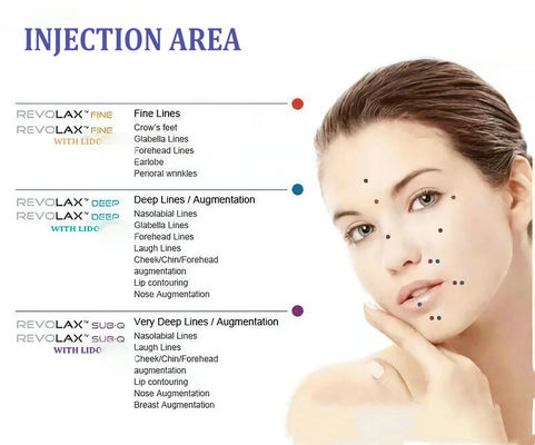 Revolax Acid Hyaluronic Tiêm môi 1.1ml
