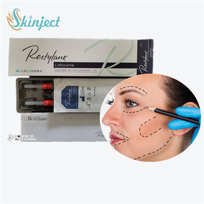 Dermal Filler Lip Tiêm, 1ml Hyaluronic Acid Lip Fillers