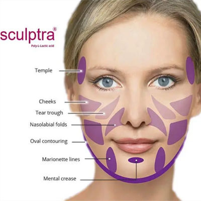 CE  PLLA Powder để kích thích Collagen