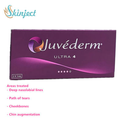 Ultra3 Ultra4 Voluma Chất làm đầy da liên kết chéo phù hợp cho da mặt