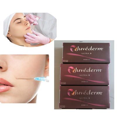 Tiêm Juvederm 2x1ml Ultra 3 Lip Dermal Filler 24mg / Ml