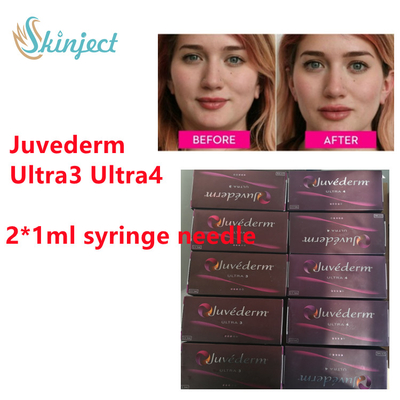 Juvederm Hyaluronic Acid Dermal Filler Juvederm Lip Filler With Lidocain 2x1ml Ultra3 Ultra4