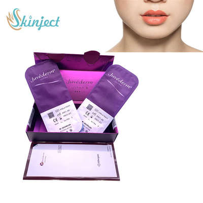Chất làm đầy da bằng axit hyaluronic 2x1ML Juvederm Ultra3 cho da mặt