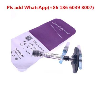 Gel Sodium Hyaluronate y tế Juvederm Voluma dành cho các dòng Glabellar