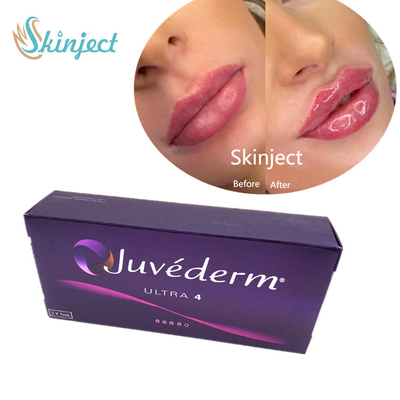Juvederm 2*1ml Chất làm đầy môi Hyaluronic Acid Chất làm đầy da với Lido Ultra4
