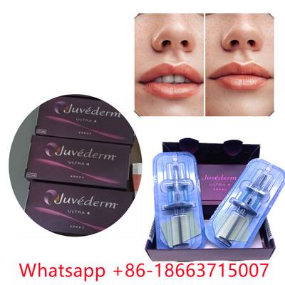 Juvederm ultra 4 (2x1ml) Tiêm Filler làm nở môi