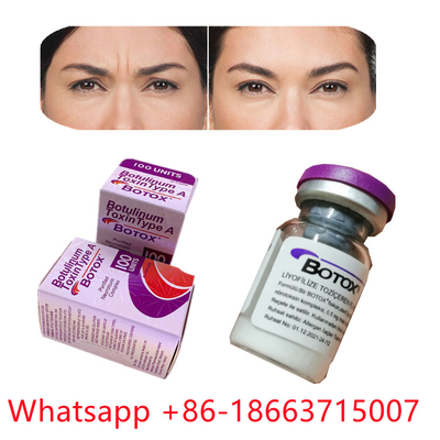 Allergan Botulinum Toxin Dạng bột  loại A