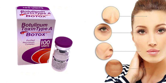 Allergan Botulinum Toxin Dạng bột  loại A