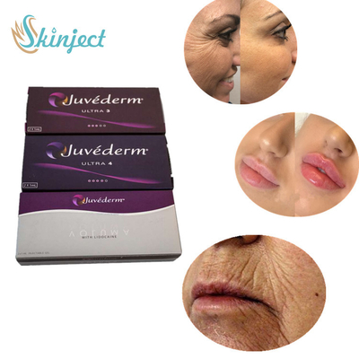 Juvederm Ultra 4 Dermal Filler Tiêm môi để tăng cường đôi môi gợi cảm