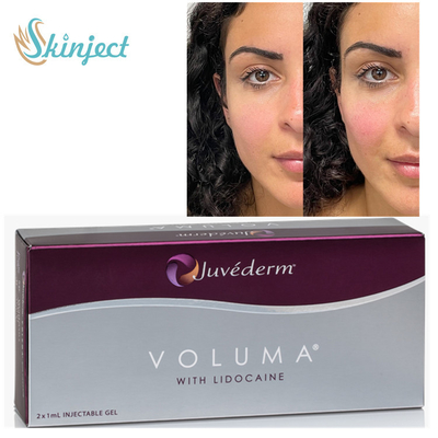 Juvederm Voluma 2x1ml HA Dermal Fillers for Cheekbone Chin Contouring