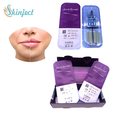 Chất làm đầy da môi Juvederm Ultra4 Lip Enlargement Hyaluronic Acid
