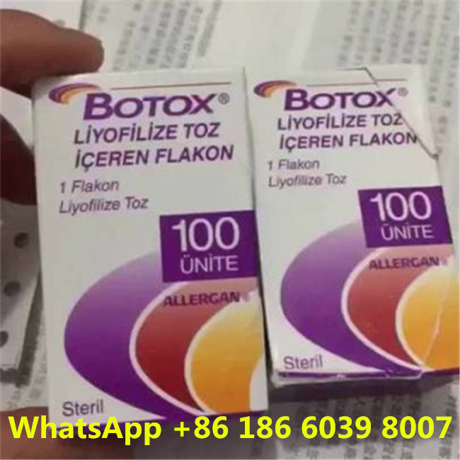 Loại A  Allergan cho các sản phẩm chống nếp nhăn 100 đơn vị