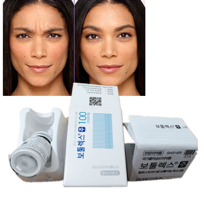 100 Iu Sản phẩm chống nhăn Hàn Quốc Botulinum Toxin  Type A
