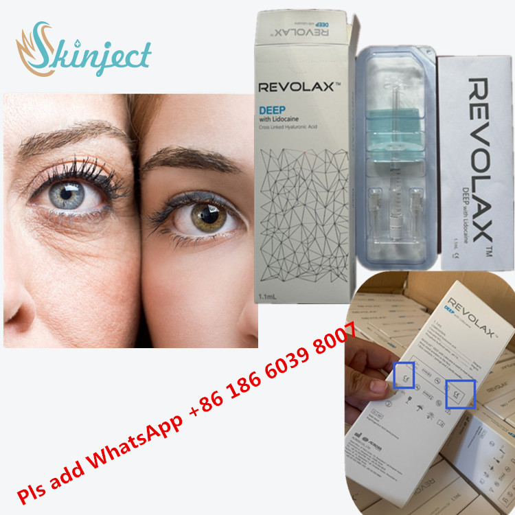 Chất làm đầy da liên kết chéo Revolax Filler Liên kết chéo HA Hyaluronic Acid 24 Mg/Ml