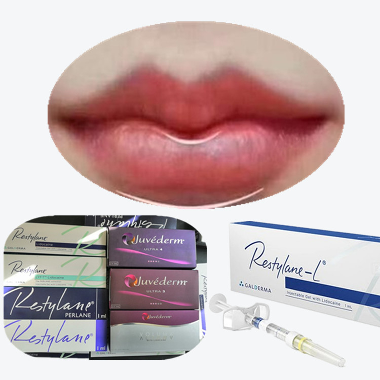Thuốc phun axit hyaluronic để lấp khuôn mặt LIDO LYFT