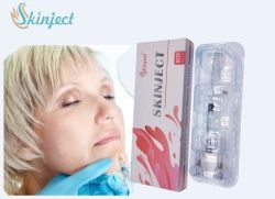 Mặt / mũi / môi / hàm Hyaluronic Acid Dermal Filler với thời hạn sử dụng 2 năm
