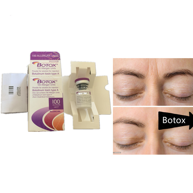 Allergan 100ui Botulinum Toxin Serum Thuốc chống lão hóa cho khuôn mặt