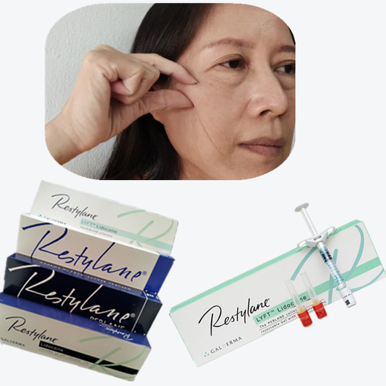 Cosmetic Cross Linked Dermal Filler HA Tiêm cho góc miệng