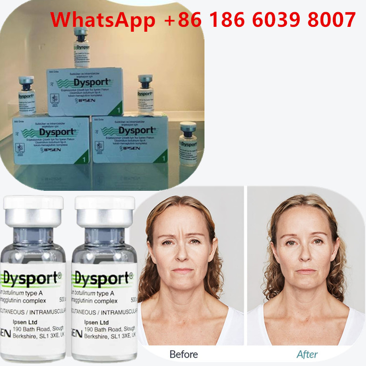 Botulinum Toxin Type A 100 đơn vị  tiêm cho nếp nhăn mặt
