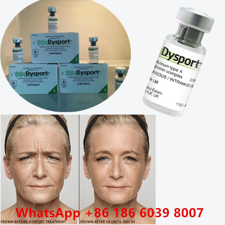 Botulinum Toxin 100 đơn vị BTX Tiêu dùng mỹ phẩm