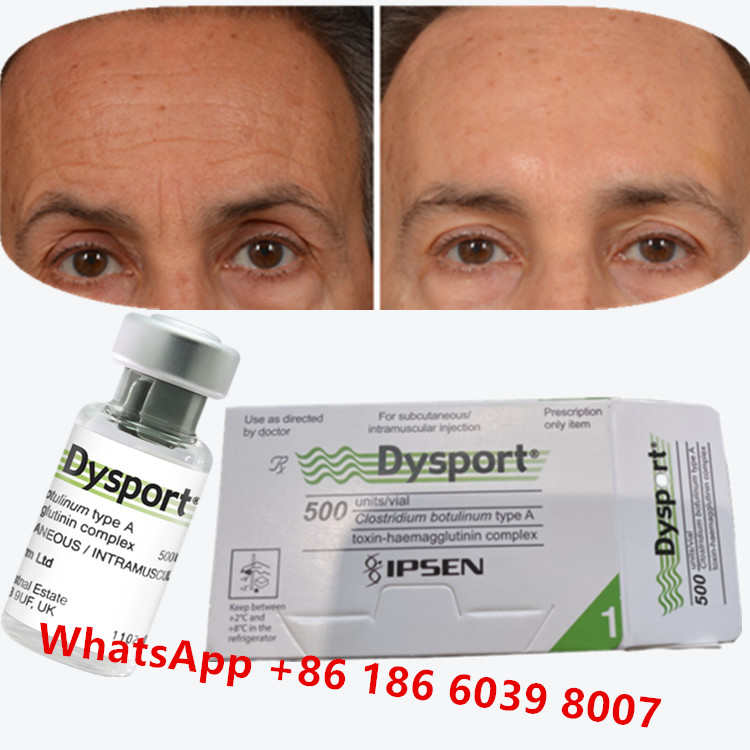 Botulinum Toxin Dysport Clostridium Botulinum Type A Đối với chân quạ