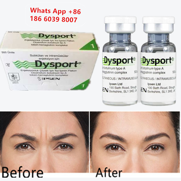Botulinum Toxin A Dysport Botox tiêm cho gia tăng cằm