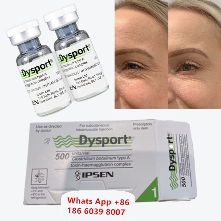 Dysport Botulinum Toxin Loại A cho Nếp nhăn rãnh lệ