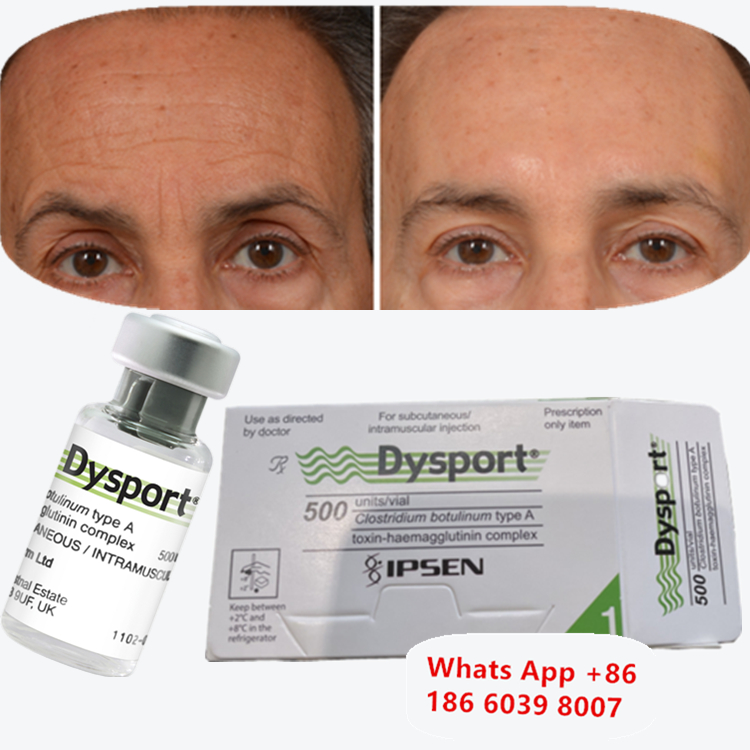 Botulinum Toxin Dysport Botox Kháng nhăn Bột đông khô cho biệt thự của cặp vợ chồng