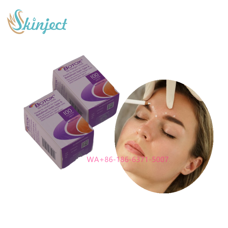 Botox Allergan 100IU Tiêm Giảm Nhăn, Xóa Nếp Nhăn Trán, Điều Trị Bằng Độc Tố Botulinum cho Làn Da Mịn Màng