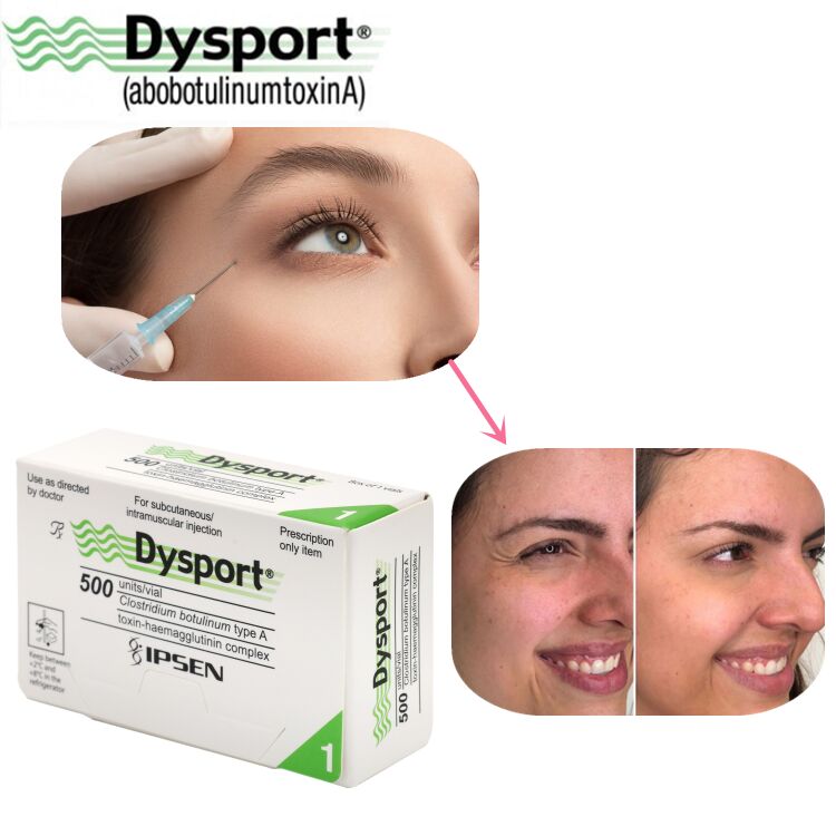 500u Dysport Xóa Nếp Nhăn Mặt Bột Đông Khô Gia Công Theo Yêu Cầu OEM Dysport