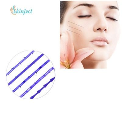 Khuôn màu tím Bánh răng PDO Chủ đề W Kim loại neo