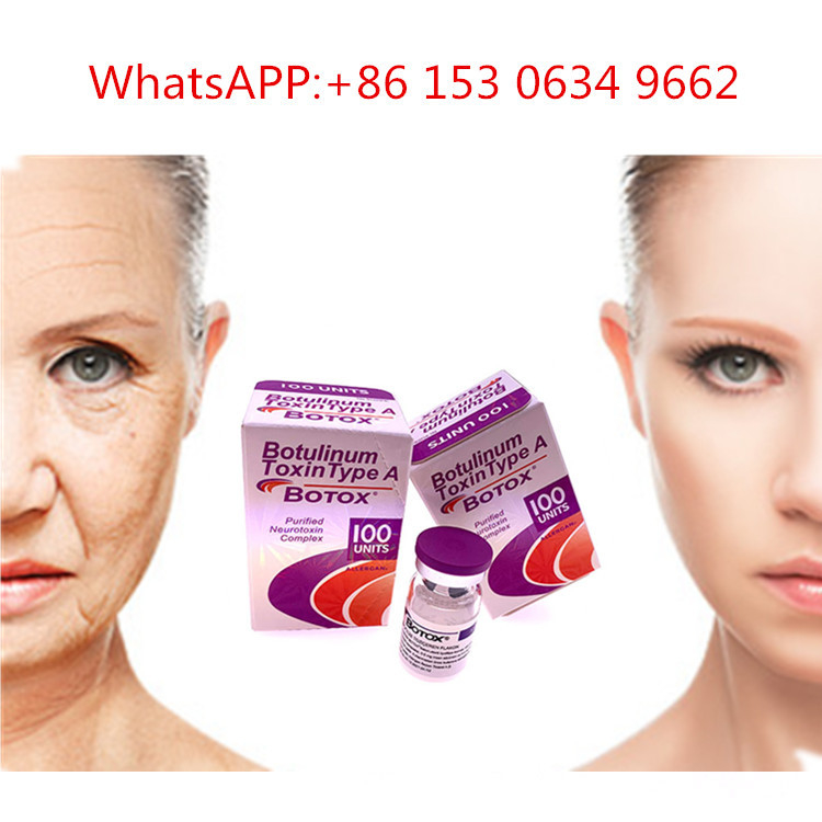 50u 100u 150u Loại A Allergan  Tiêm Botulinum Toxin để chống nếp nhăn