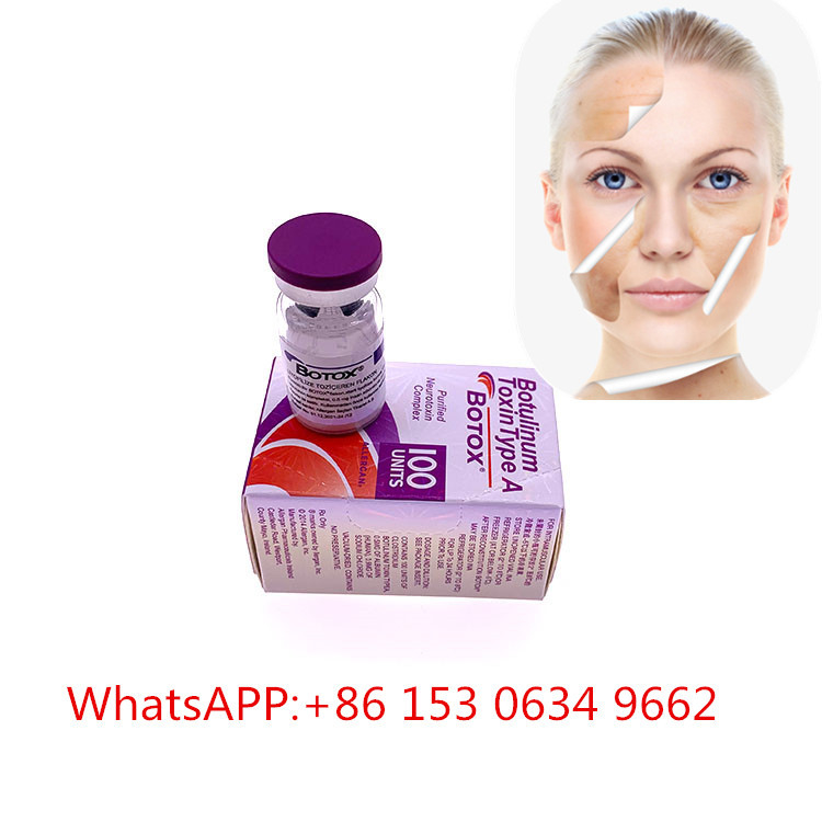 100 đơn vị Tiêm chất làm đầy da Botulinum Toxin  Loại A