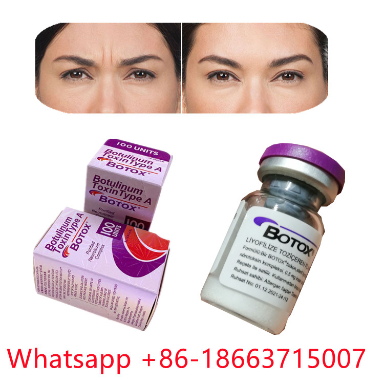 Allergan Botulinum Toxin Dạng bột  loại A
