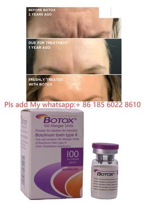 Tiêm Botox Allergan, Botulax, Độc tố Botulinum, Xóa nếp nhăn