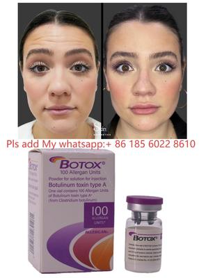Botulax Độc tố Botulinum Dysport Allergan Botox để Giảm nếp nhăn và Thẩm mỹ