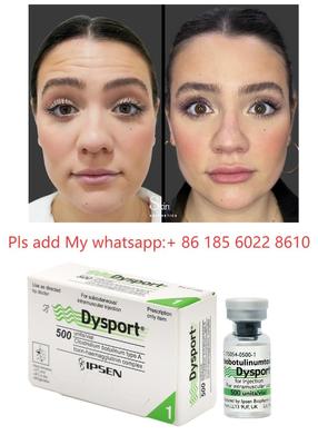 Tiêm Dysport 500iu Chống nhăn Botulinum Toxin Allergan Botulax